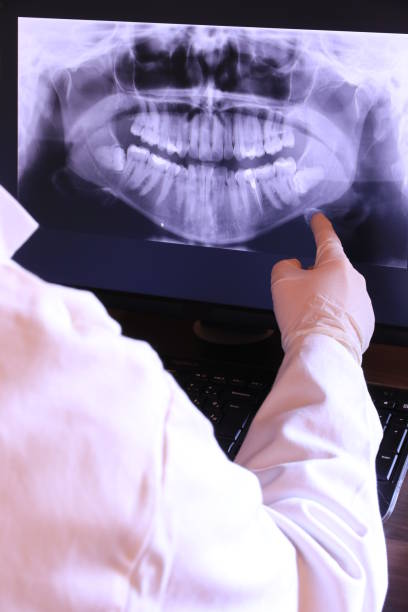 Best Emergency Gum Treatment in Itasca, TX